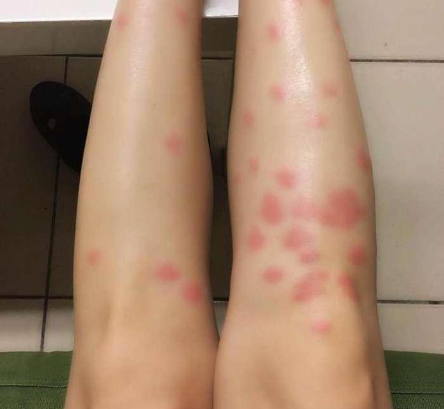 跳蚤其实一直在你的家中