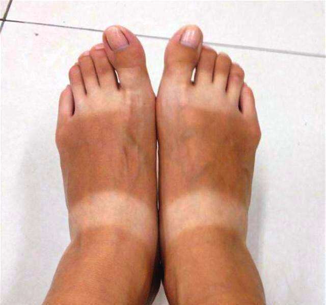 脚被晒黑只需简单小方法,双脚恢复白皙光滑