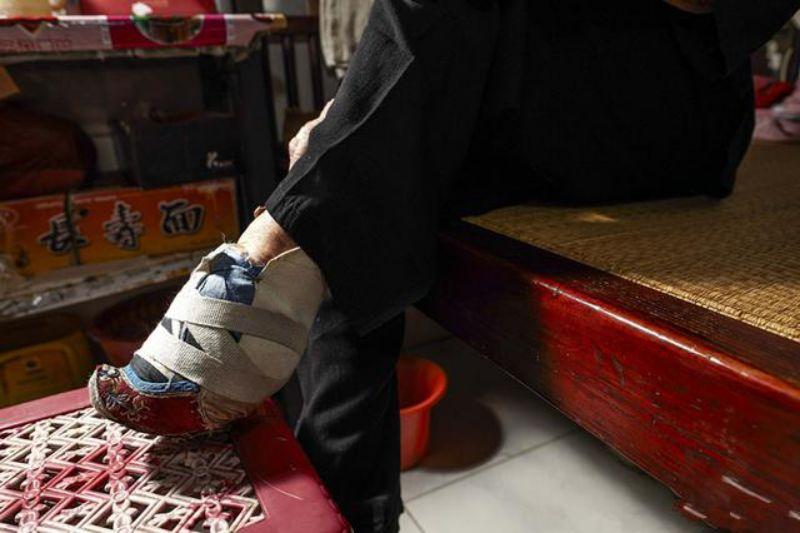 看到这双脚,你才知道裹脚陋习对女性多残忍了!真的"三寸金莲"