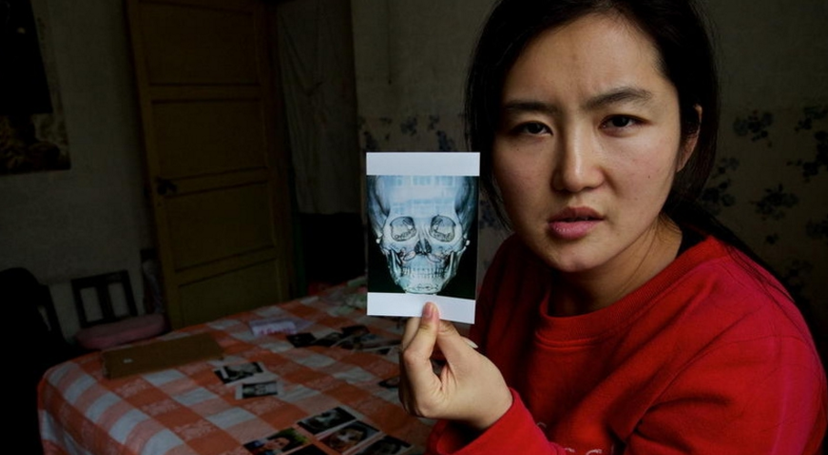 这些中国女孩不远万里去"整形"换脸,术前想变明星,术后想自杀