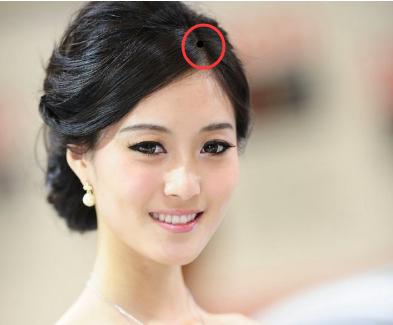 女人头发里藏痣发中藏有痣的女人大多数都是出生家境良好,从小好命