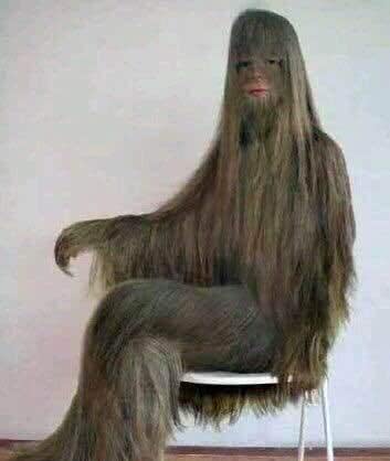 科学家认为这是人类及其少见的"返祖现象".