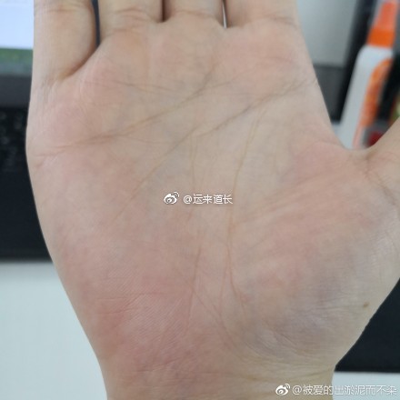 你智智慧线断开,断开时完全明显的中断,可以说你非常聪明