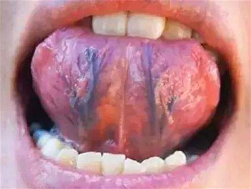 心脏好不好看舌头如果没有这4个现象恭喜你的心脏还很健康