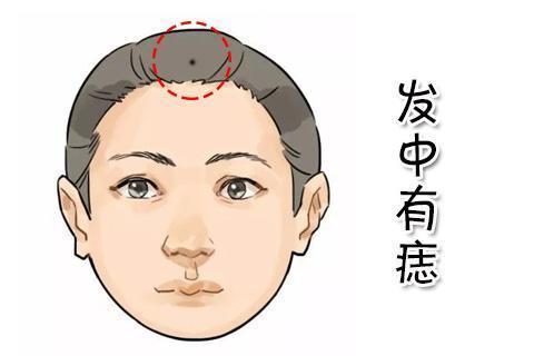 算命的说,身上有这4颗痣,无论男女,天生好命,健康长寿不愁钱