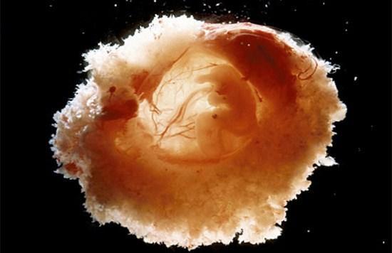 胎盘|羊水|宝宝_新浪新闻