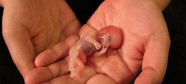 怀孕6个月狠心打胎, 婴儿出来还有呼吸, 医生泪哭: 造孽