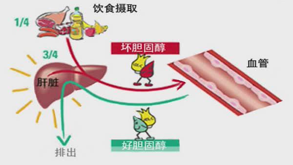 甘油三酯和胆固醇高怎么办?5招快速有效降血脂,疏通血管