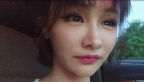 miss正面回应是否整容:你觉着我好看了,那就是整了