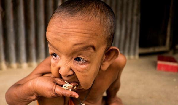 大家都以为他是患有侏儒症的老头, 而母亲称他才四岁