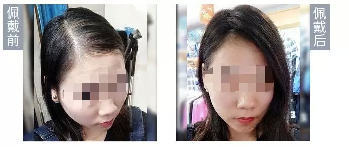 中国秃头男子图鉴：娘秃秃一个，爹秃秃一窝？