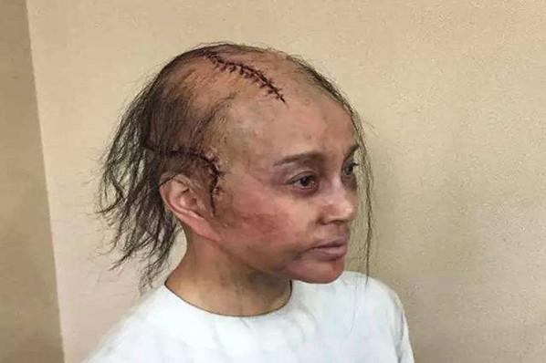 娱乐圈挑战光头的女明星第二名最漂亮最后一个太吓人