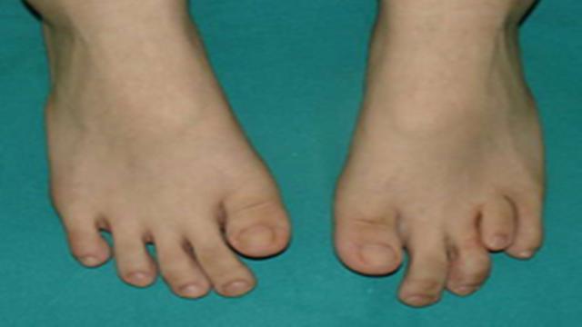 并且整个脚部感到很舒服,拥有长脚趾的人比较健康而且还很长寿