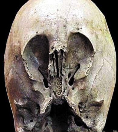 墨西哥千年墓葬出土后惊现"异形头骨"