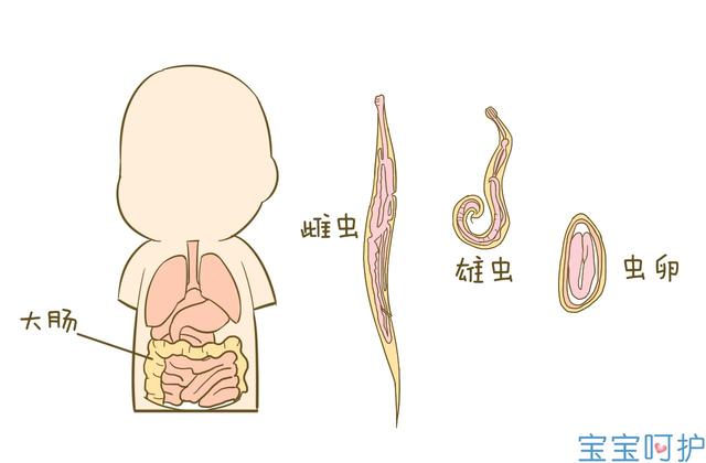 育儿小知识:宝宝这是长蛔虫了吗?