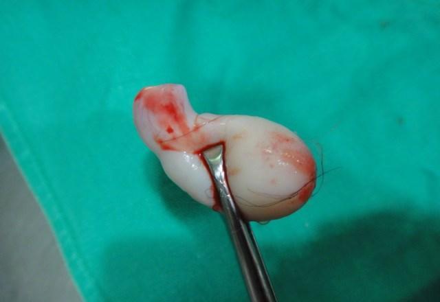 高龄产妇顺产9天后,莫名掉出"一大块肉",医生检查后怒斥无知