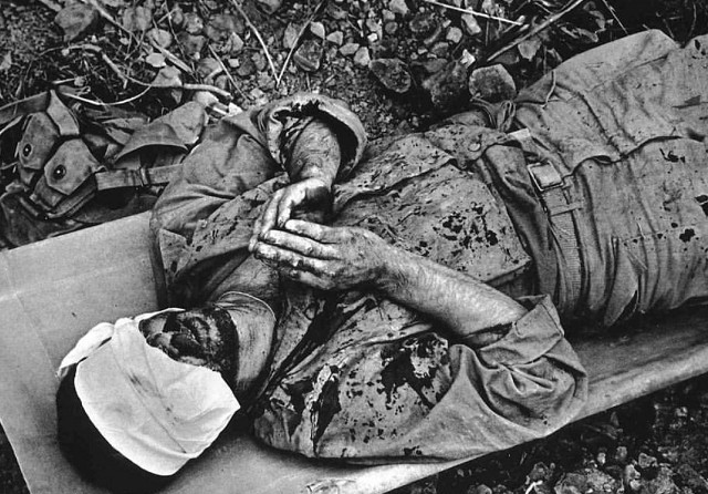 一个受伤的士兵在祈祷,小编觉得他在祈祷战争早日结束吧!