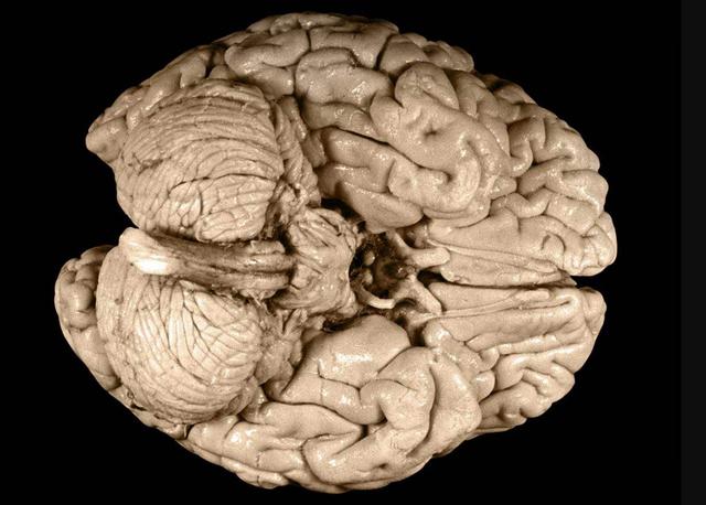 爱因斯坦的狂热粉丝爱他就带他的大脑切片环游世界