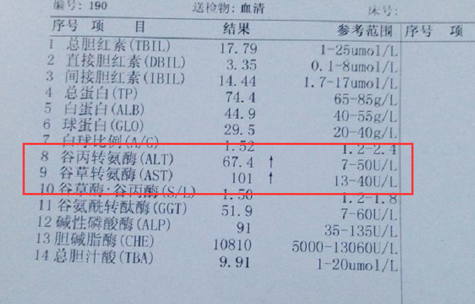 肝炎加重转氨酶持续升高是否常做这3事快吃这2物降酶保肝