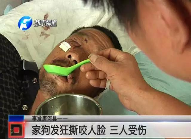 疯狗咬人脸被打死 狗主人拒不赔偿还要求伤者赔狗