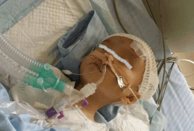 一岁宝宝喝了这玩意被医生诊断为重度脑瘫! 还给孩子喝的要停下来