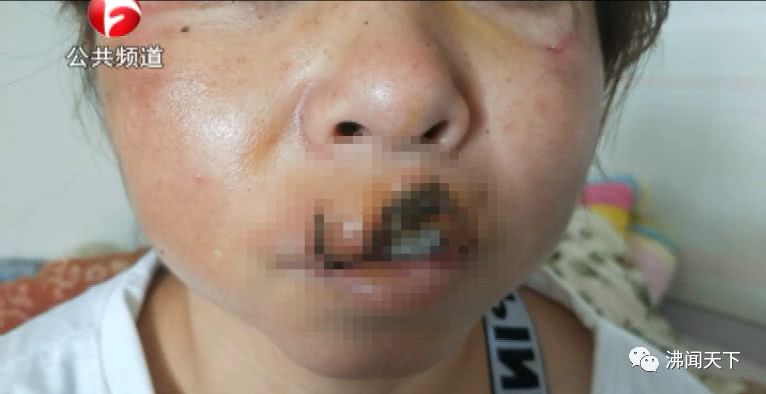 法院门外,安徽一女子被人当街按倒,嘴唇被啃掉!