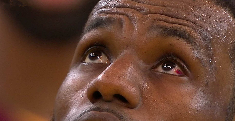 格林戳眼詹姆斯事件剧情大反转 罪魁祸首是TT