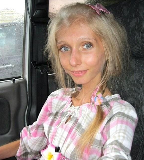 俄罗斯美女主播惨变骷髅,减肥走火入魔的后果太可怕