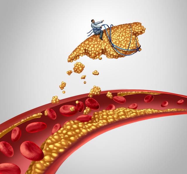 一旦头部有3种表现,脑部血管已堵,想挡脑梗入侵,可多吃2蔬菜