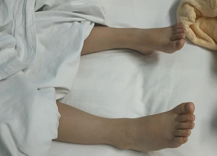 瘫痪儿童重新站立行走,全家老幼一起来送感恩