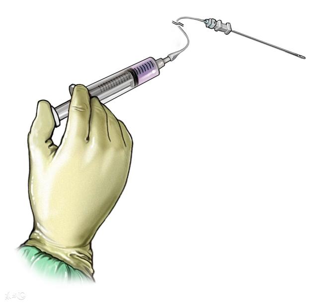 老公坚决不同意无痛分娩,称麻药会影响孩子智商,宁可痛死也不打