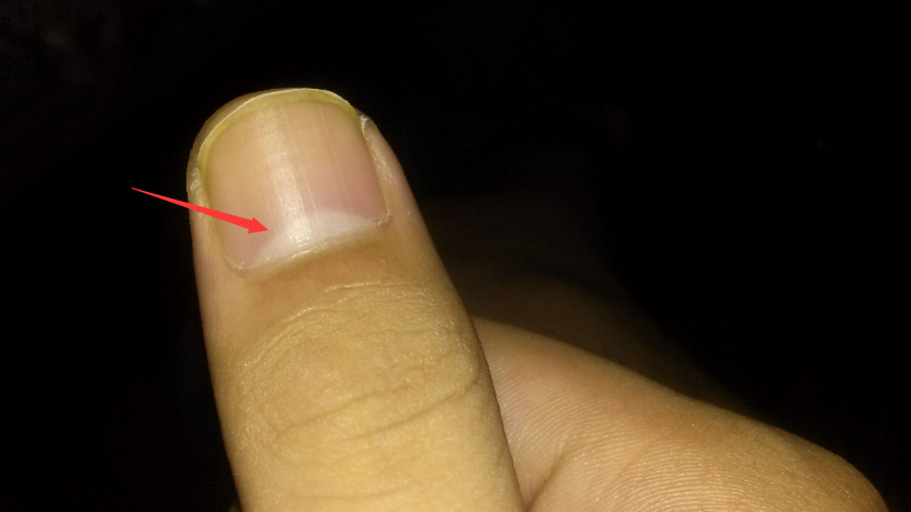 指甲上的半月痕,到底代表着什么?