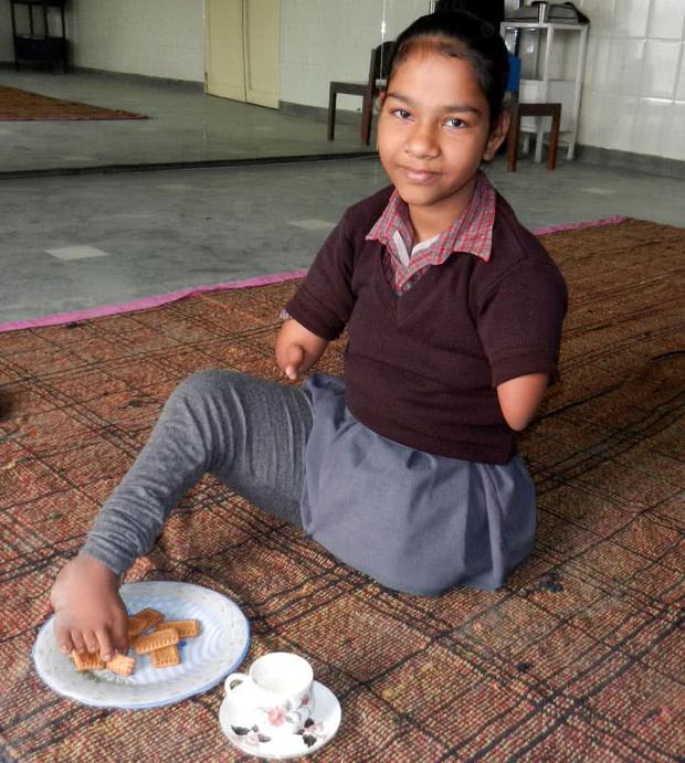 12岁少女生来只有一条腿,但她却比健康孩子更出色