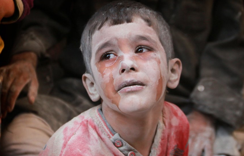 叙利亚局势空前紧张 战火下的儿童让人看着心酸!