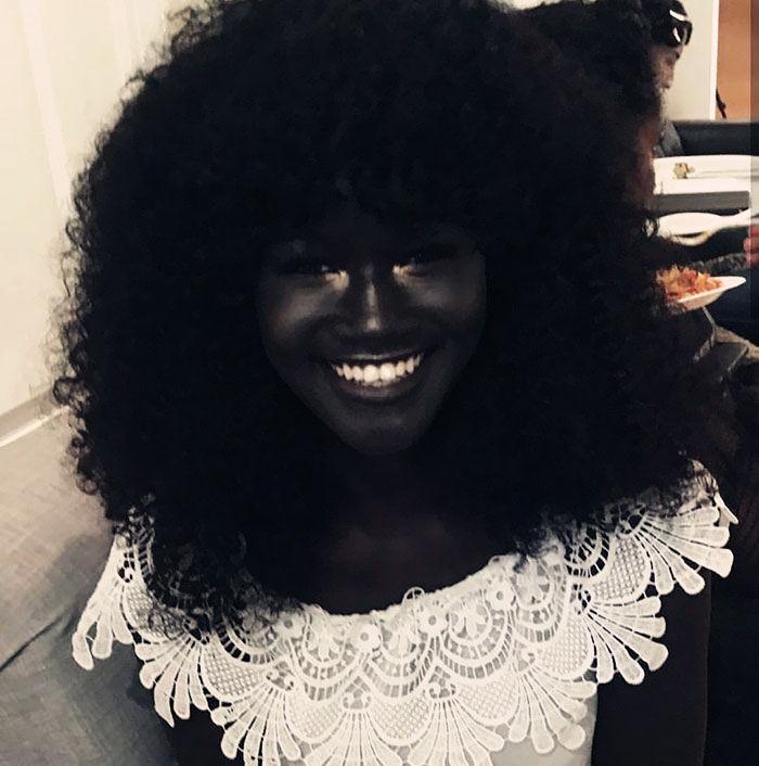 世界上最黑的女人, 晚上出去可隐身, 但现在却成为了一位名模