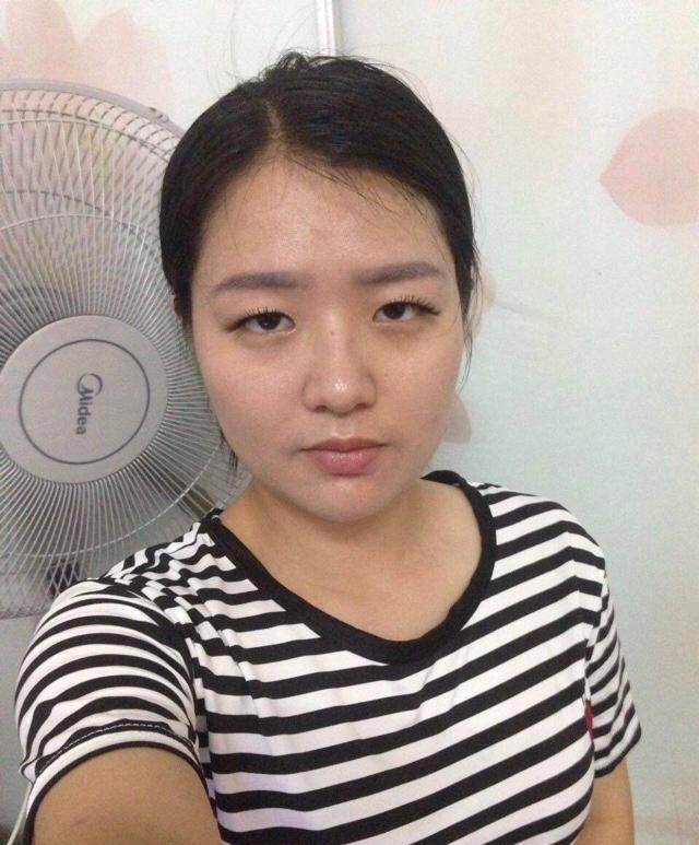 为什么有人割了双眼皮也不好看