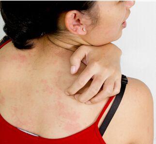 春季过敏频发,浑身奇痒无比,养生专家教你增强体质,远离过敏!