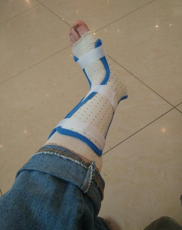 被快递车撞伤腿,声称要送快递就开车走了!是快递重要还是人重要