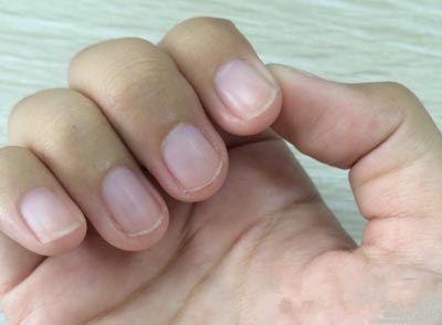 40岁以后,能不能健康长寿?关键看这8点|身体|寿命|指甲_新浪新闻
