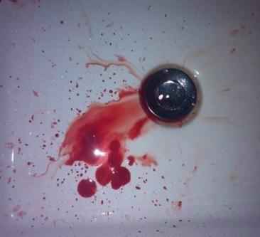 可胸腔突然闷闷地疼,猛的一咳嗽,竟然咳出了一口鲜血,鲜血喷溅在洗手
