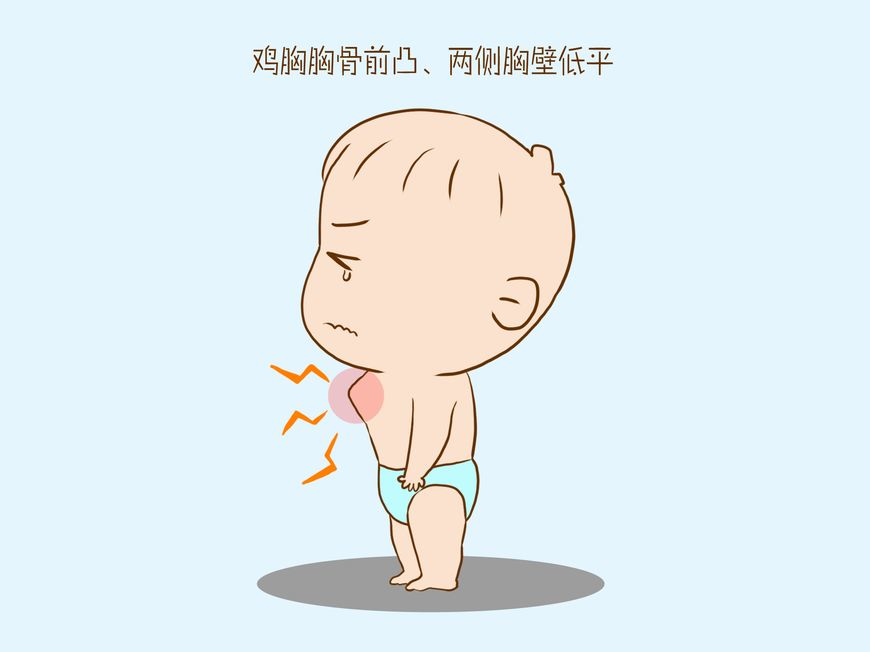 小孩子被检查出患有鸡胸让妈妈想起一件旧事羞愧的低下头