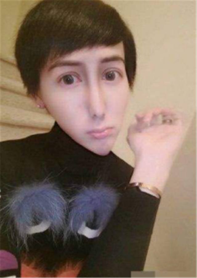 网红蛇精男刘梓晨,整容后辣眼睛,曾销声匿迹,今连父母都认不出