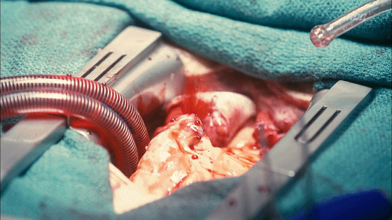 560_315gif 动态图 动图