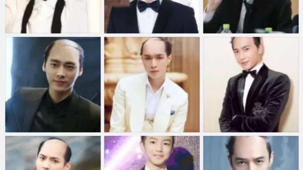 中国秃头男子图鉴：娘秃秃一个，爹秃秃一窝？|秃头|脱发|光头|图鉴|烧烤_新浪新闻
