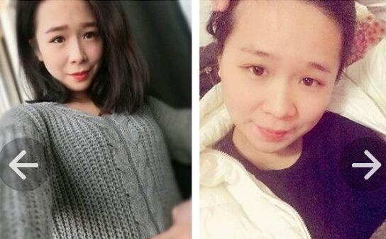 女人生孩子前后对比,看了辣眼睛