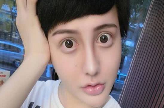 "蛇精男"要融掉全脸玻尿酸,回归大自然,网友:别,不要吓我