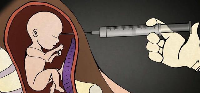 现在也是随着社会的一个进步的发展,人们的思想也都是慢慢的开放了