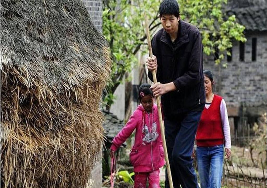 小伙患巨人症高226米女友只156米站凳子才能亲到他