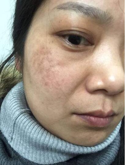 皮肤科医生:有可能是这个原因|代谢|黑色素|色斑_新浪网