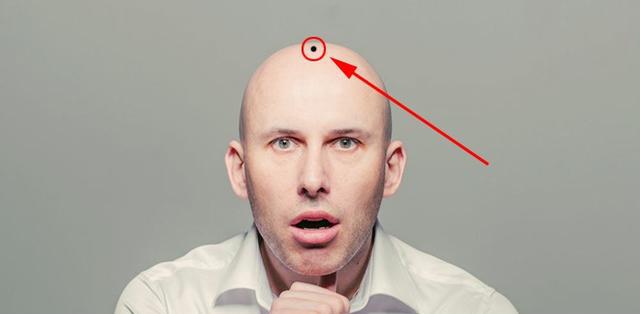 命里藏金的三颗富贵痣,无论男女,占一颗就是享不尽的荣华富贵